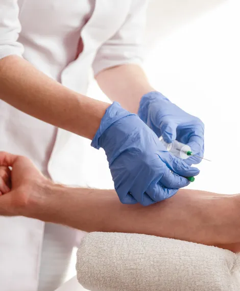 Toma de muestra de sangre en el brazo